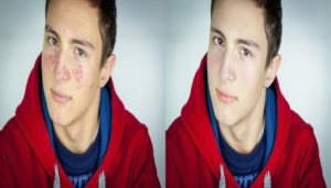 Photo Retouching Service